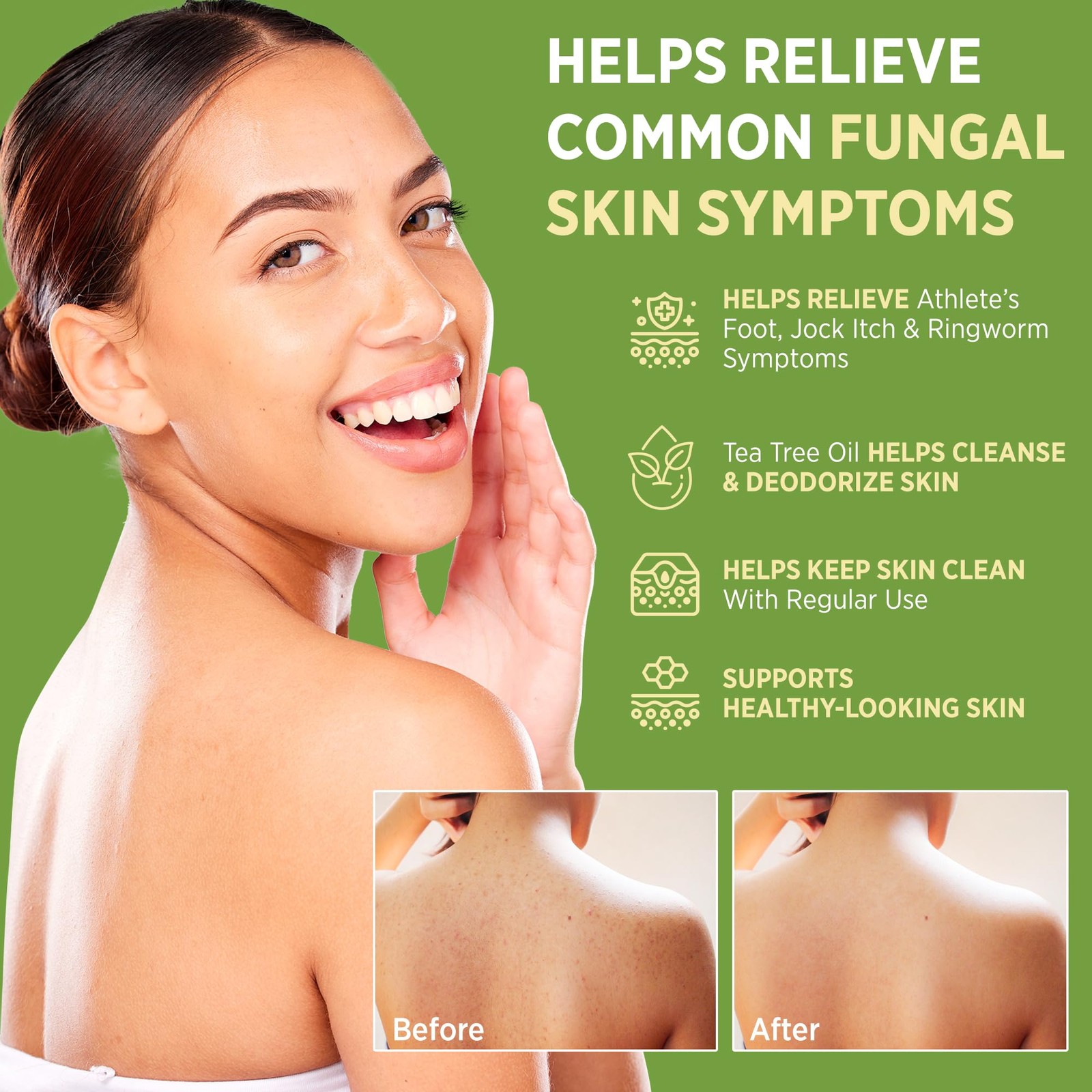 Roycederm Antifungal Antibacterial Tea Tree Soap | Treatment Soap for Face &…