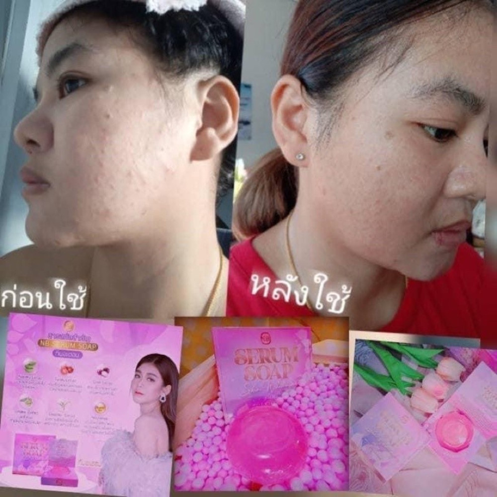 NB soap Facial Cleansing Serum gentle, 60g. X 6 pink box, fragrant, soft bubbles