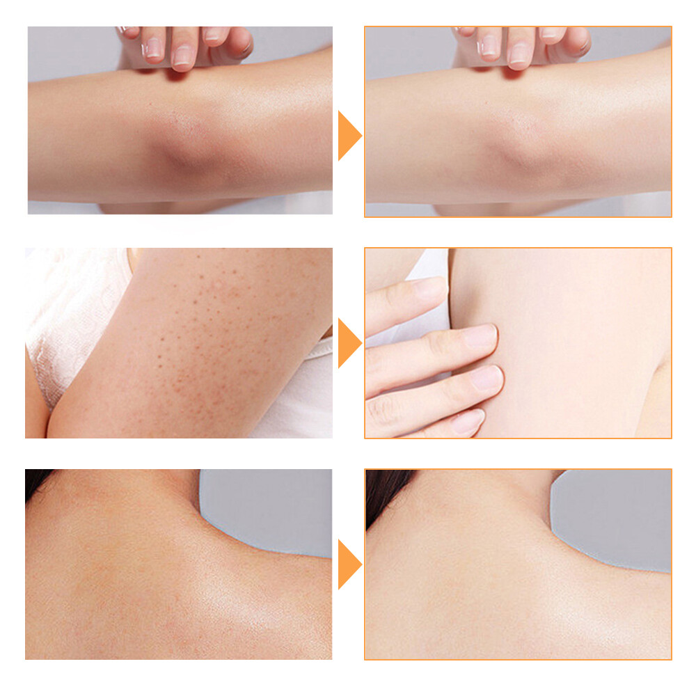 2 Pcs Tumeric Soap, Dark Spots , Skin Glow, Brighter Skin, Scars, All Skin types