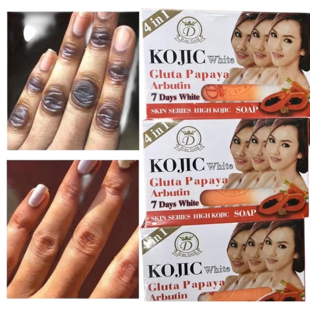6-Pk Kojic Arbutin Brightening Bar Soap Skin Dark Spot Remover 160g [USA Stock]