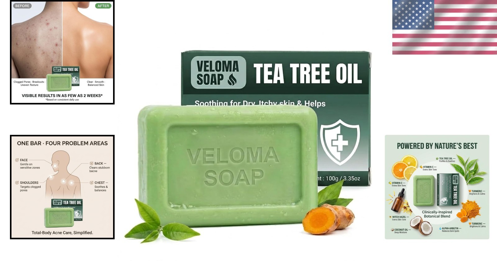 Veloma Antifungal Soap,Veloma Soap,Soothing Tea Tree & Eucalyptus, Deep Pore Cle