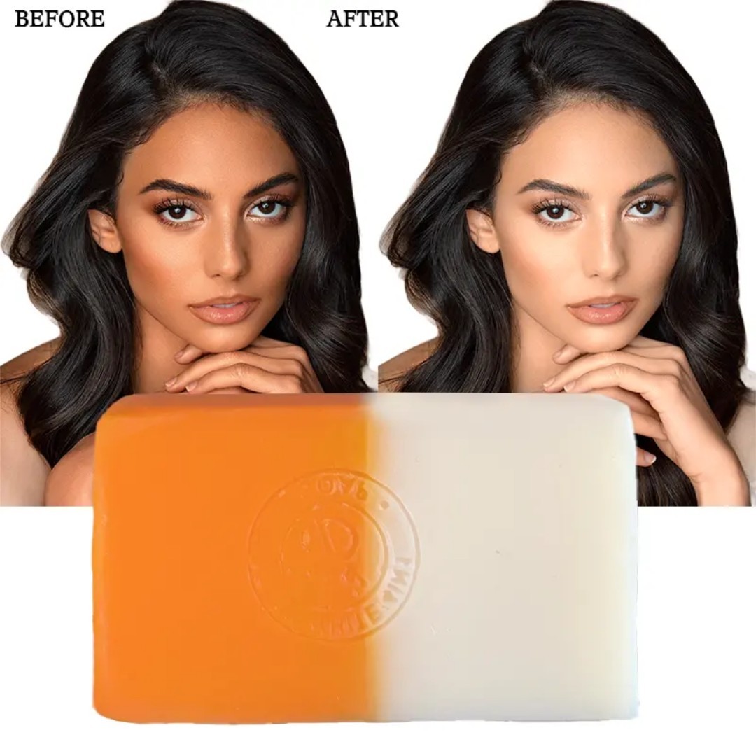 6-Pk Kojic Arbutin Brightening Bar Soap Skin Dark Spot Remover 160g [USA Stock]