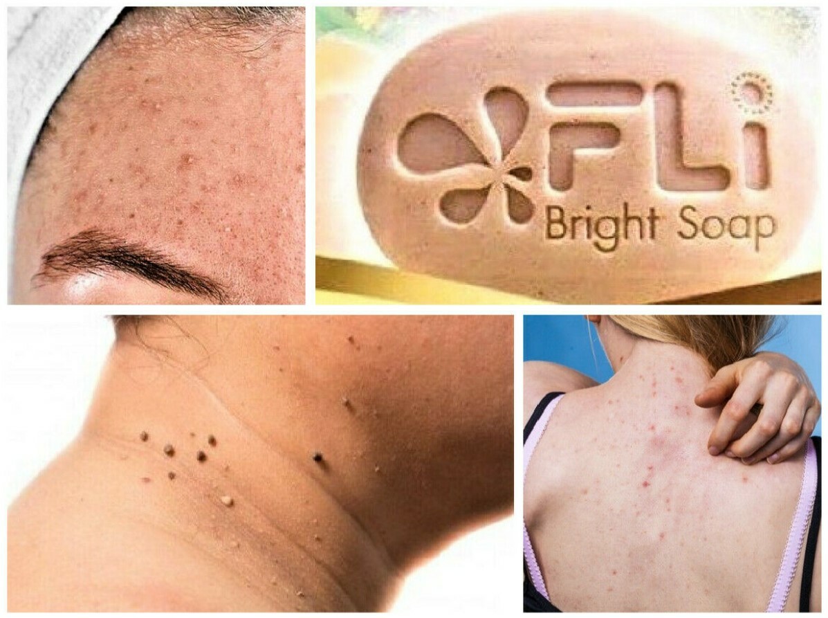 3x 100% Herbal FLI Soap Freckles Dark Spots Radiant Aura Smooth Skin Soft