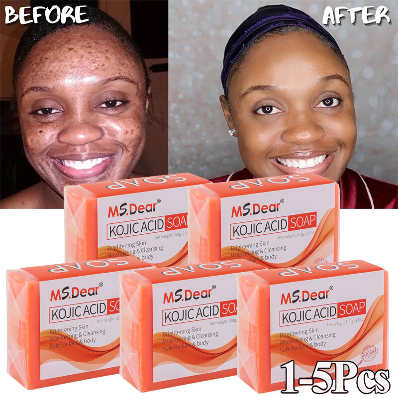 Kojic Acid Soap Dark Spot Remover Skin Lightening Face Whitening Body Bleaching