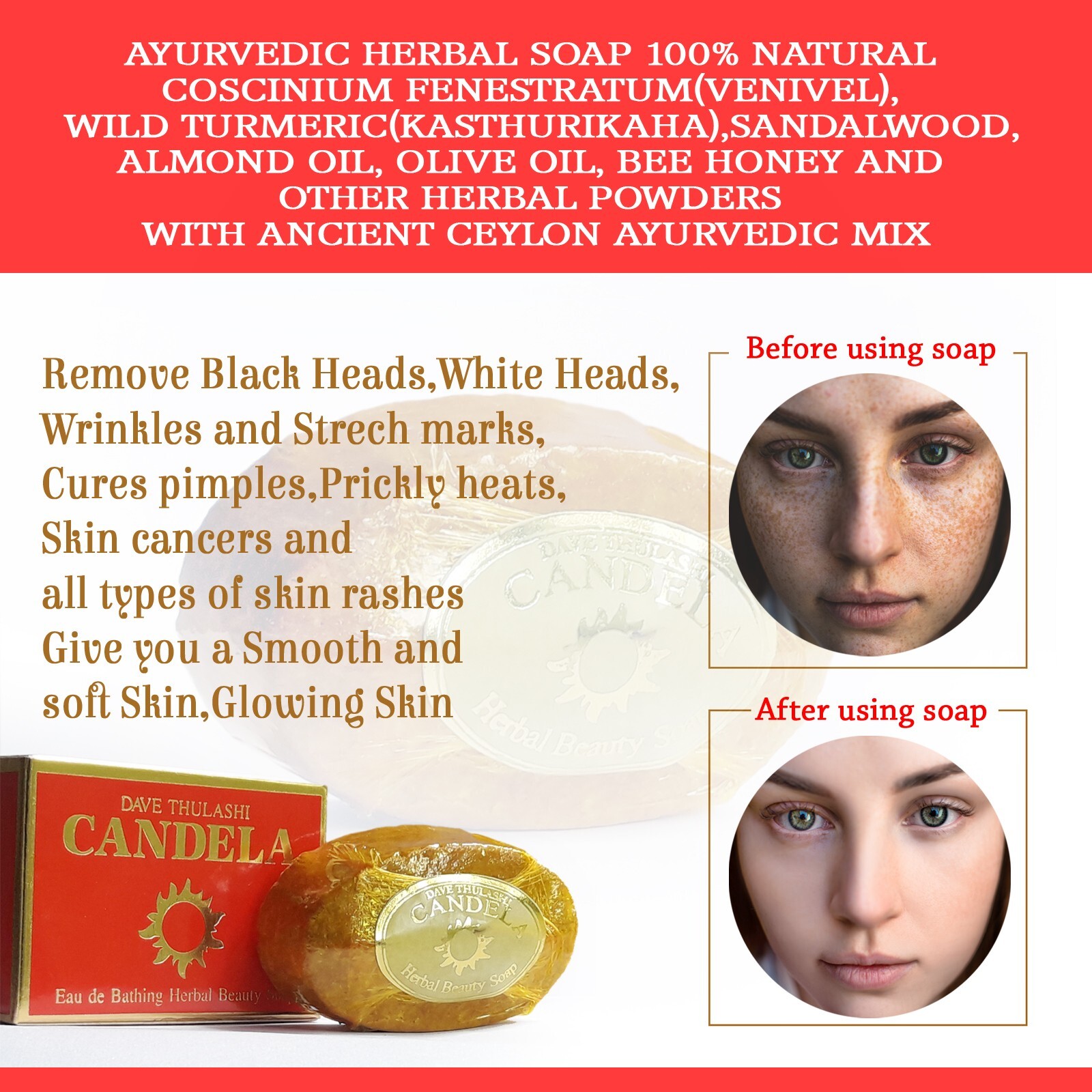 ayurvedic Wild Turmeric Soap (Remove Eczema, Psoriasis, Acne, Dry Skin…) 76g