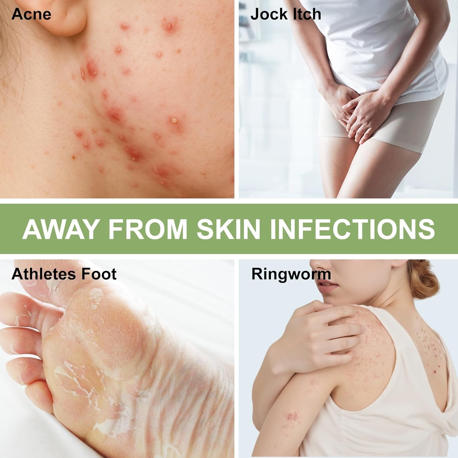 Antifungal Medicated Soap Bar, Athletes Foot Jock Itch Ringworm Yeast Infection