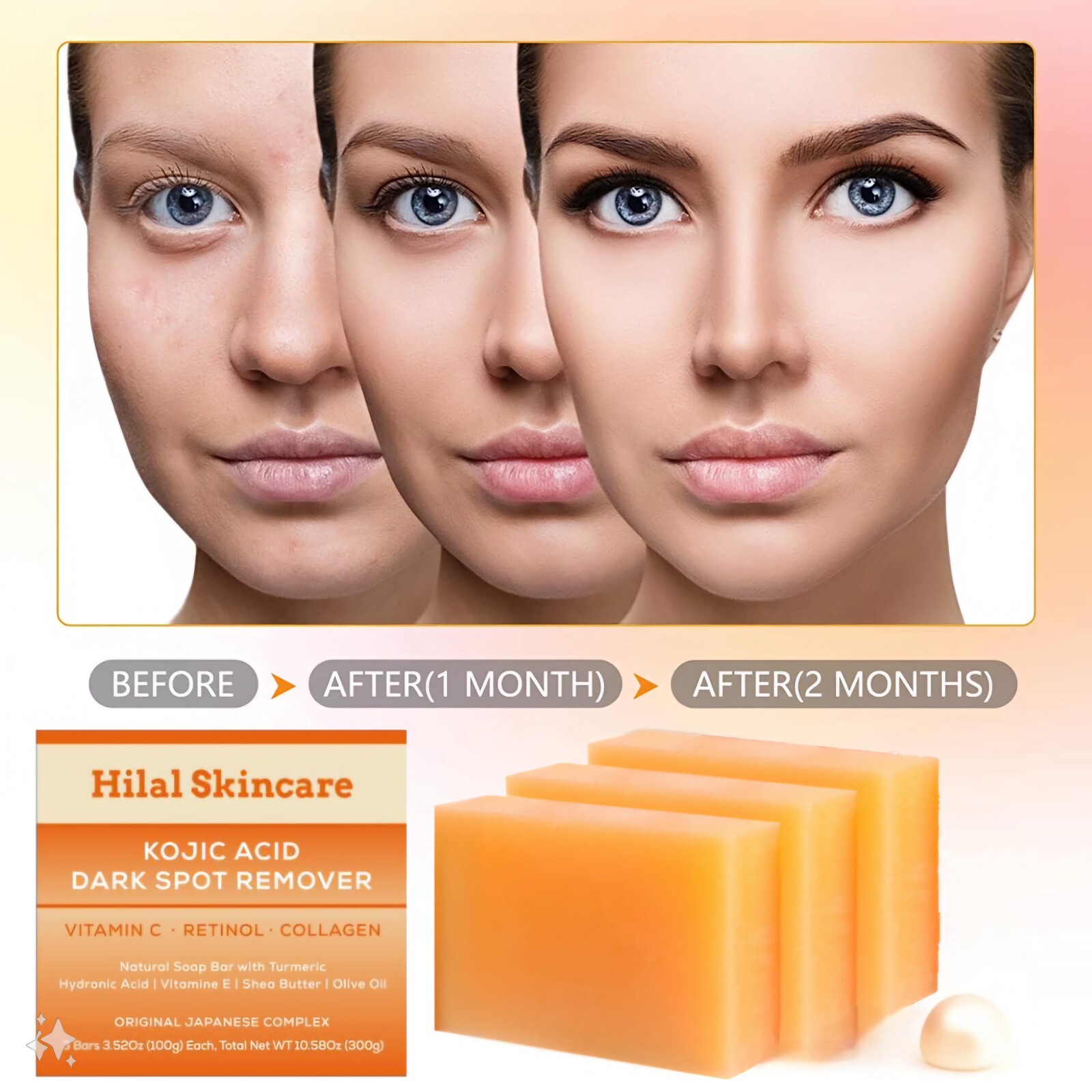 Kojic Acid Soap