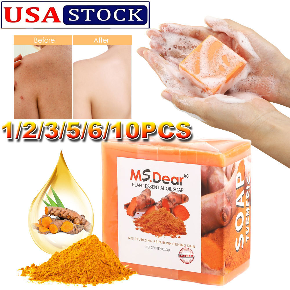 10x Tumeric Soap Skin Whitening Dark Spots lightening Acne Brightening Turmeric
