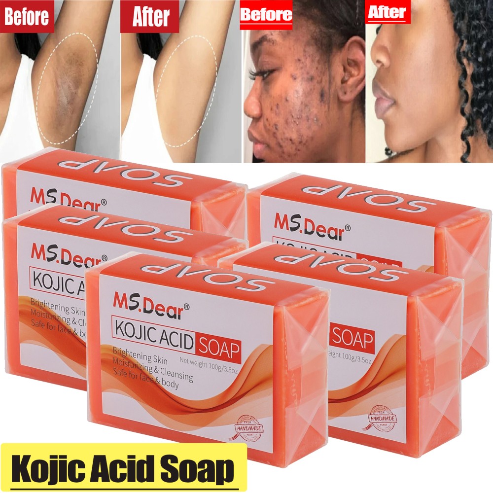 5/3X Kojic Acid Soap Acne Dark Spot Remover Skin Lightening Whitening Face Body