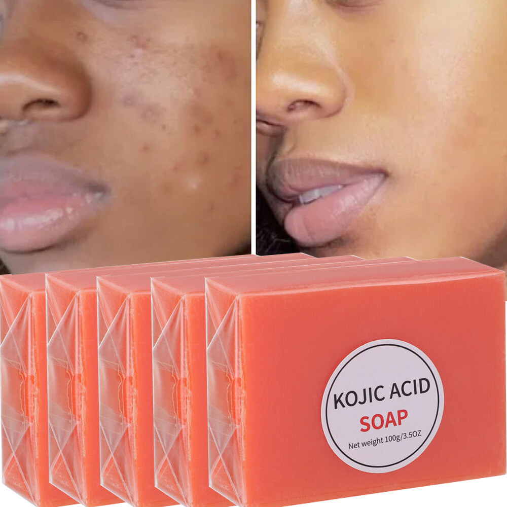 5/2X Kojic Acid Soap Dark Skin Clean Whitening Bleaching Lightening Brightening