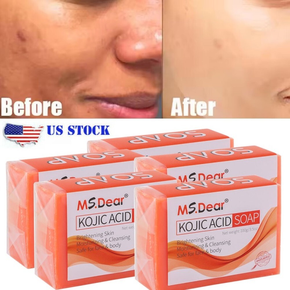 5/3X Kojic Acid Soap Acne Dark Spot Remover Skin Lightening Whitening Face Body