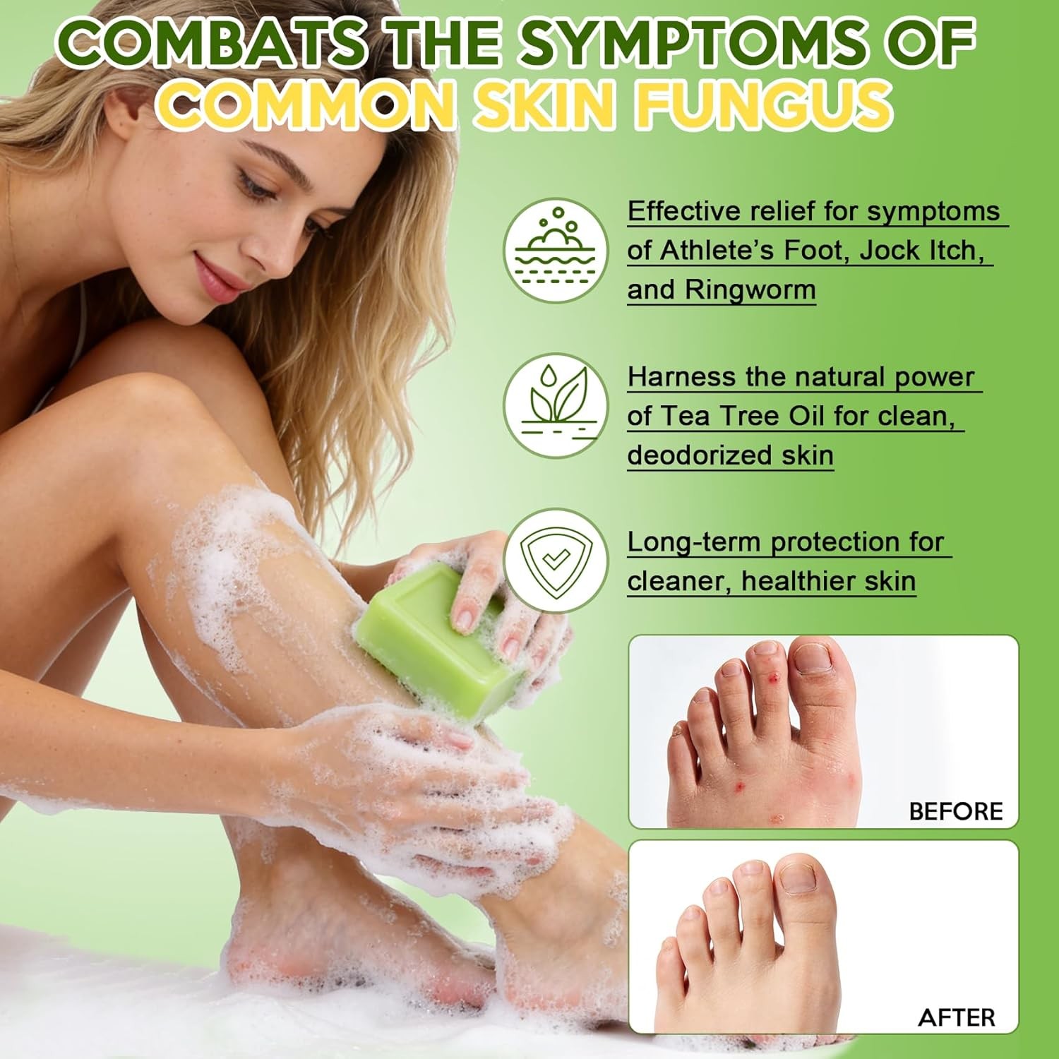 Antifungal Bar Soap – Tea Tree Oil Soap – Athlete’S Foot Treatment for Jock Itch