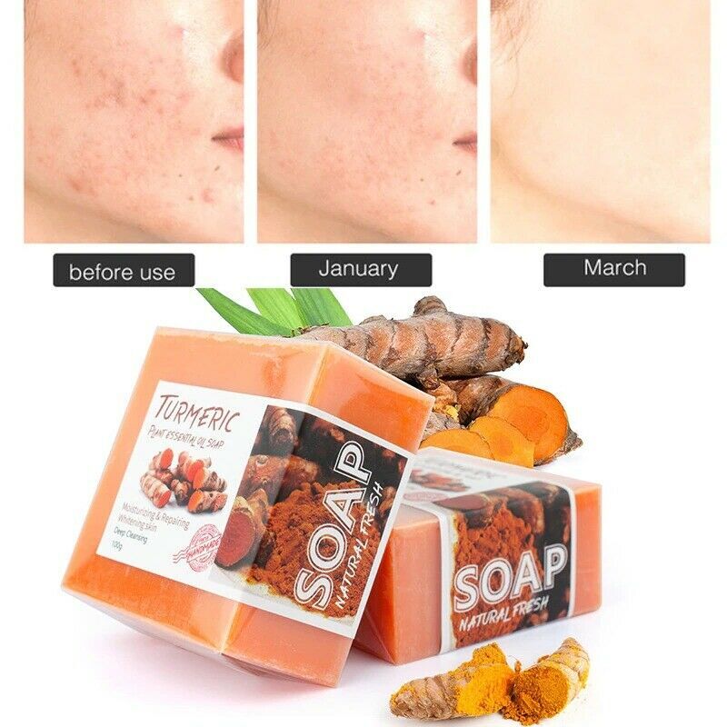 1/2PCS Tumeric Soap Ginger Anti-Acne Dark Spots Removal Body Whitening Soap Bar