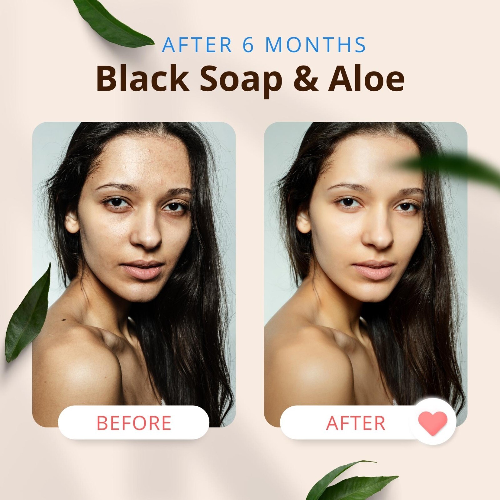 Navigating Acne Soap Options on eBay