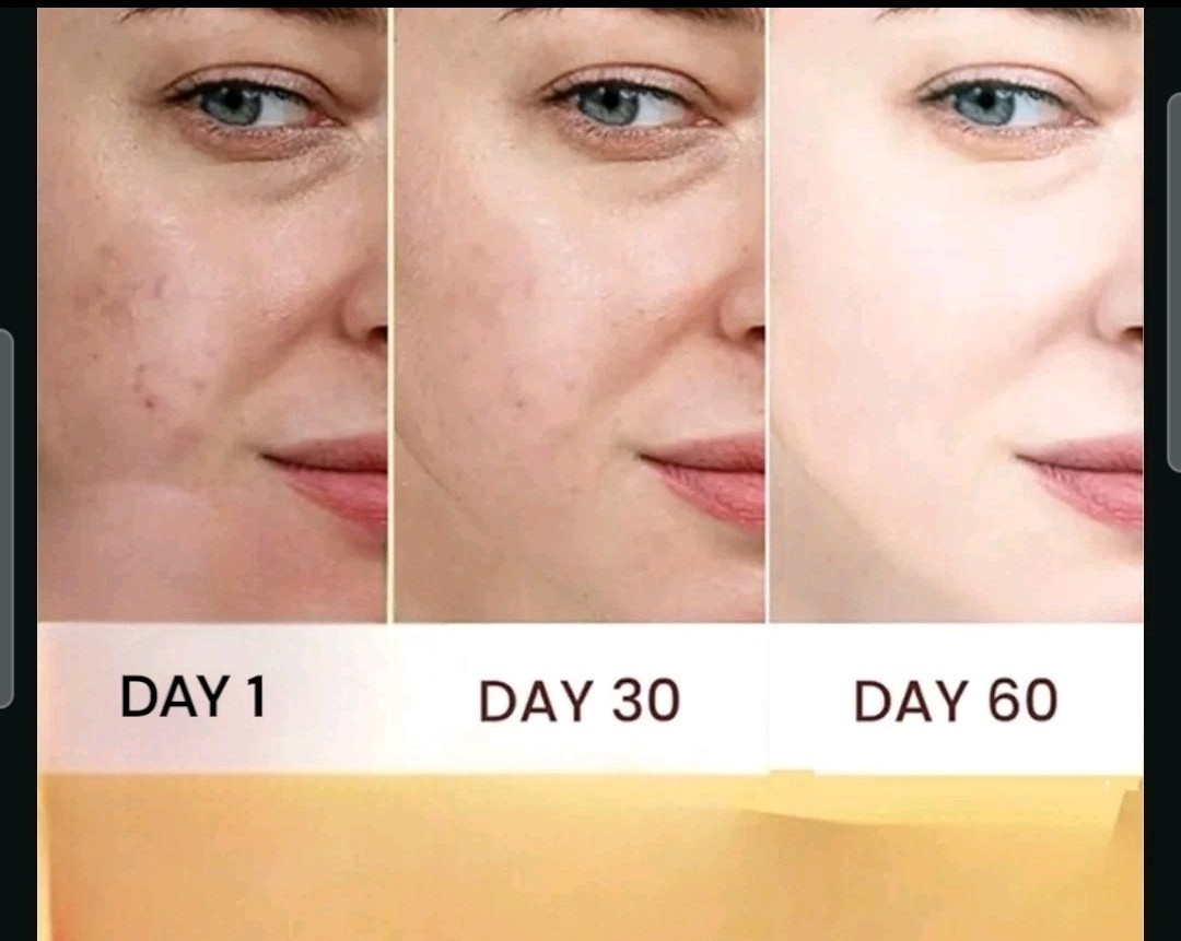 6-Pk Kojic Arbutin Brightening Bar Soap Skin Dark Spot Remover 160g [USA Stock]