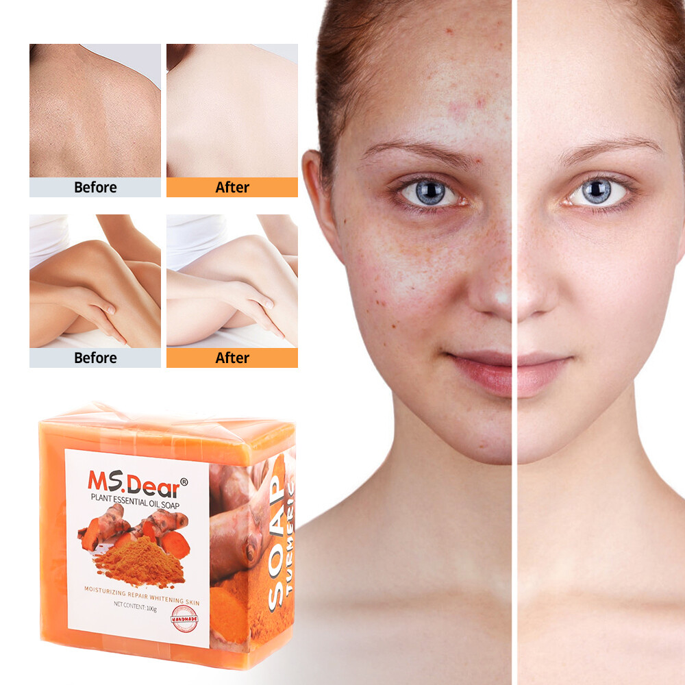 10x Tumeric Soap Skin Whitening Dark Spots lightening Acne Brightening Turmeric