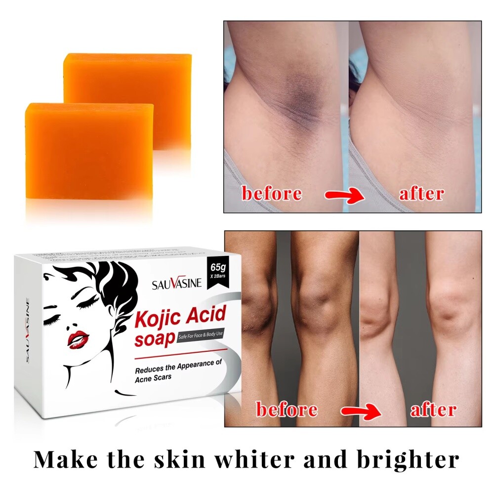 5/3X Kojic Acid Soap Acne Dark Spot Remover Skin Lightening Whitening Face Body