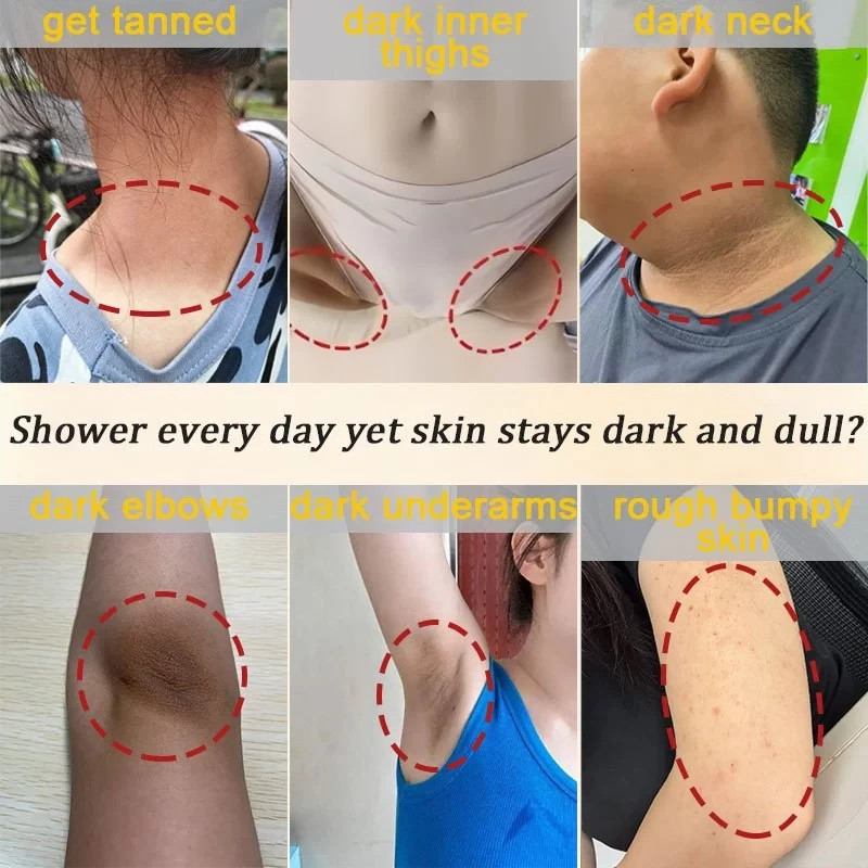 Vitamin C Whitening Soap Removal Exfoliating Sunburn Moisturizing Cleansing