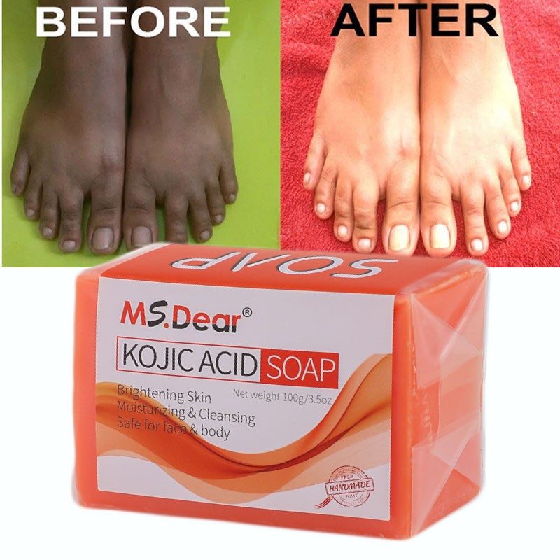 Dark Skin Whitening Bleaching Lightening Kojic Acid Soap Brightening Face & Body
