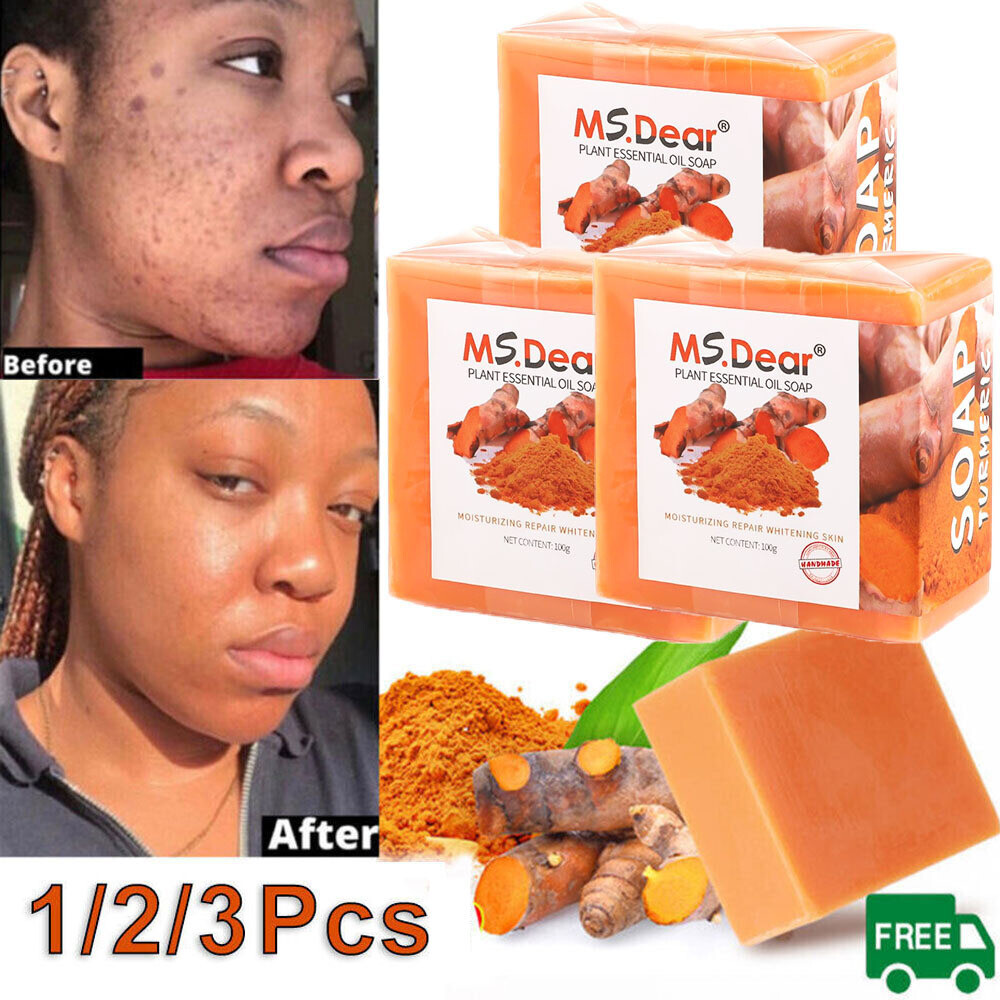 5-1x Tumeric Soap Skin Whitening Dark Spots lightening Acne Brightening Turmeric