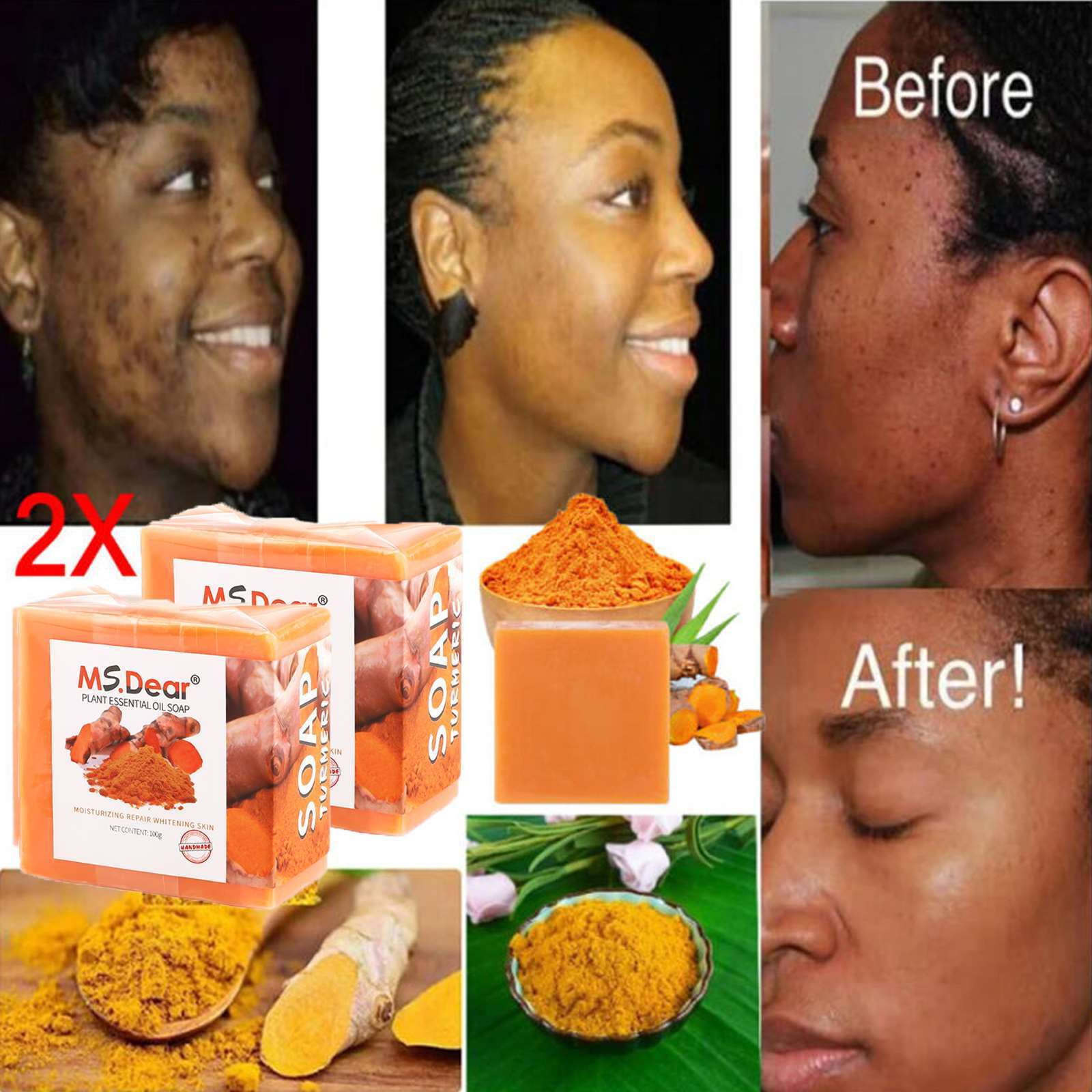 2pcs Tumeric Soap For Dark Spots, Skin Lightening, Anti Acne Skin Cleansing Soap