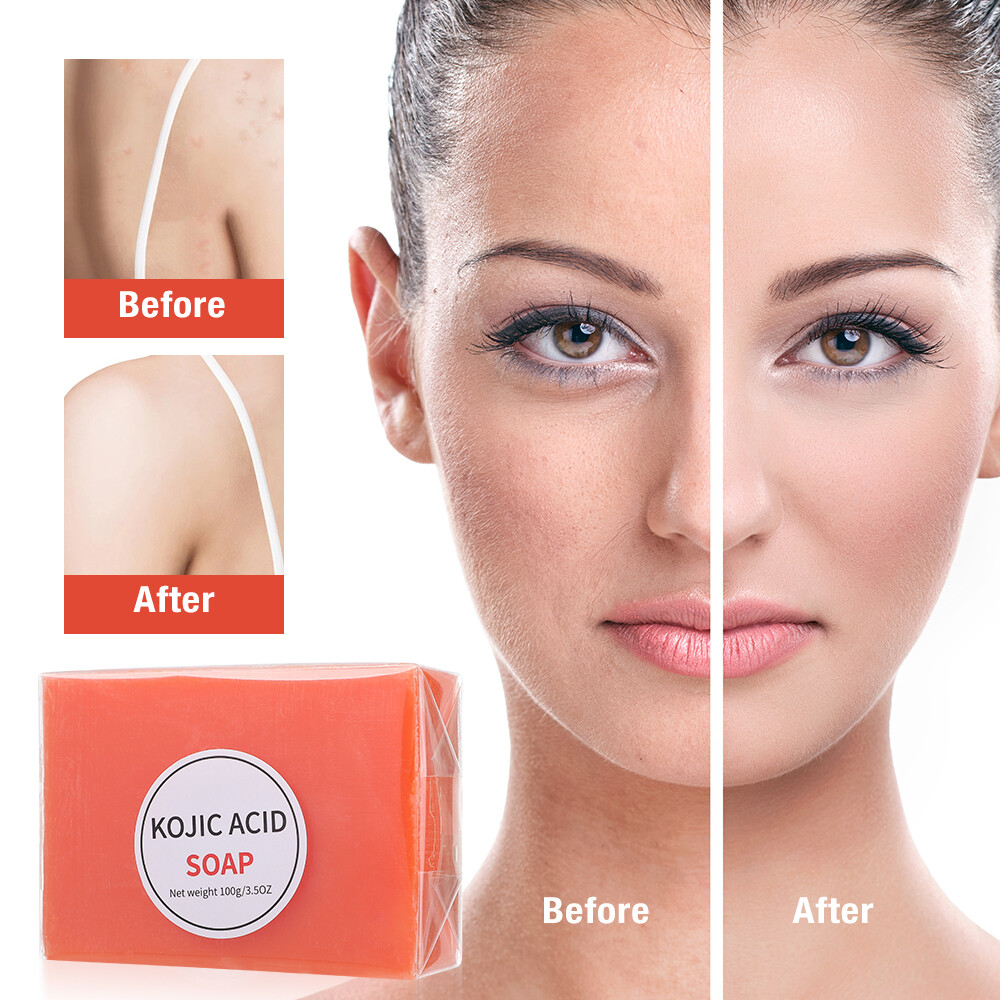 2PCS Skin Brightening Soap Original Kojic Acid Soap for Dark Spot Whitening 100g