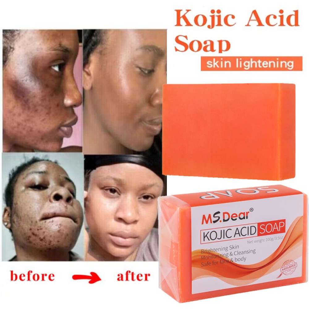 1-5X Kojic Acid Soap Dark Spot Whitening Turmeric Skin Bleaching Lightening 100G