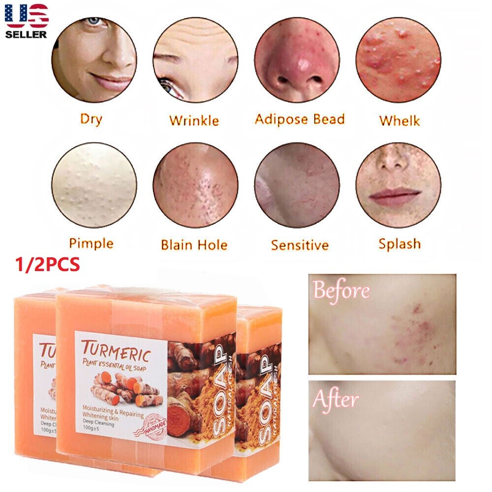 1/2PCS Tumeric Soap Ginger Anti-Acne Dark Spots Removal Body Whitening Soap Bar