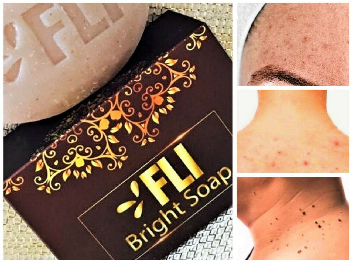 3x 100% Herbal FLI Soap Freckles Dark Spots Radiant Aura Smooth Skin Soft