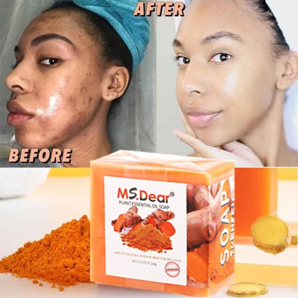 3PCS Tumeric Soap For Dark Spots, Skin Lightening, Anti Acne Skin Cleansing Soap