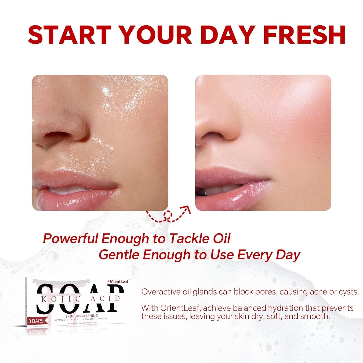 Hydrating Kojic Acid Soap Trio with Fresh Citrus & Shea Butter – Travel Size