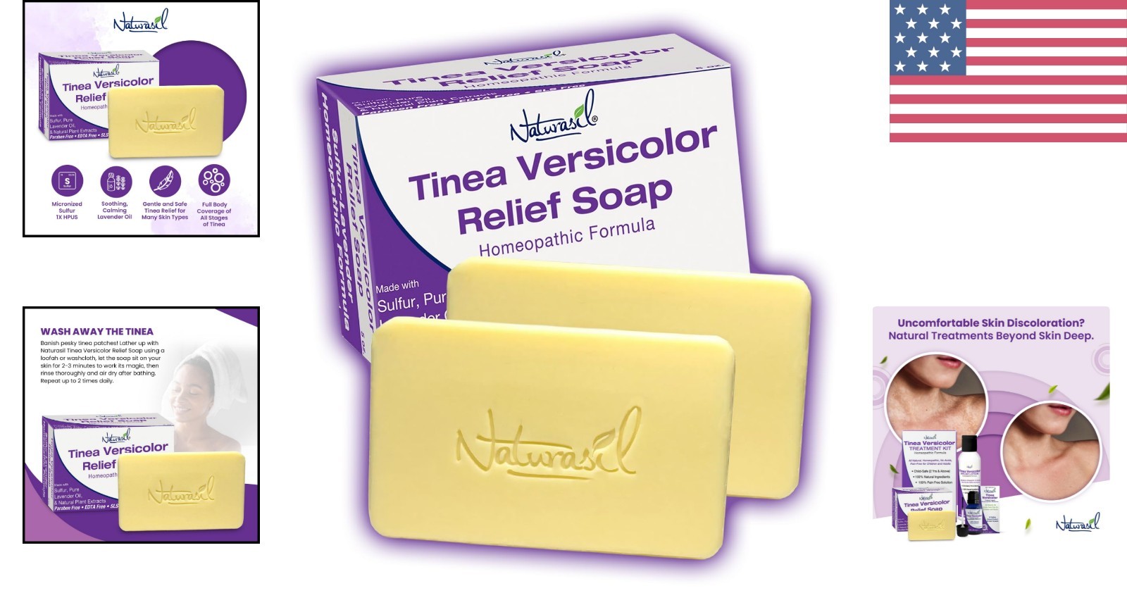 Homeopathic Antifungal Soap Pack – 2 x 5oz Bars, Restores Skin Pigment Naturally