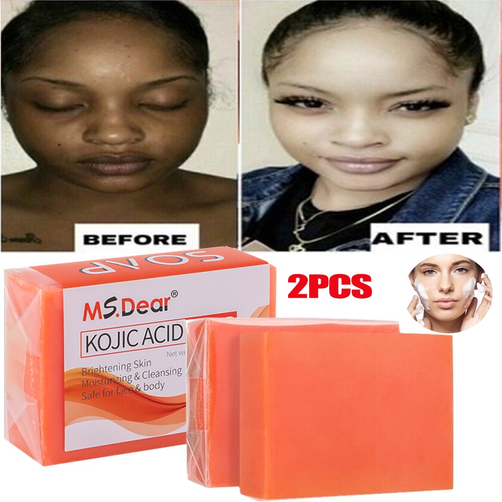 5/3X Kojic Acid Soap Acne Dark Spot Remover Skin Lightening Whitening Face Body
