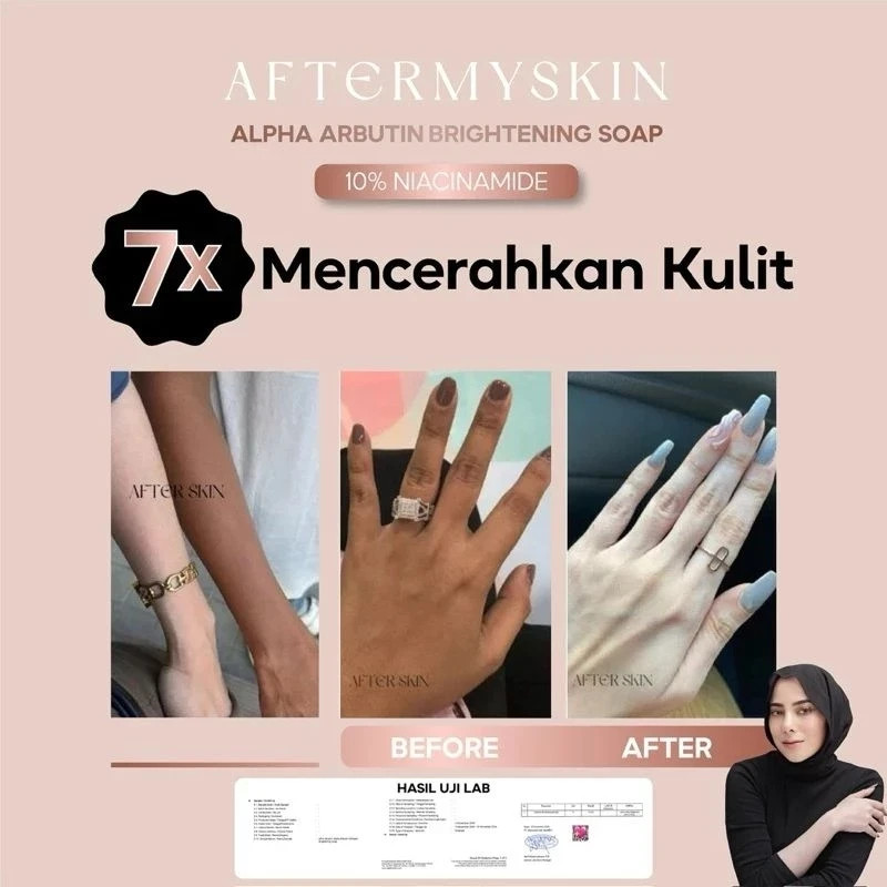 AFTERSKIN – Aftermyskin Alpha Arbutin Soap 1 PCS, 2 PCS, 3 PCS