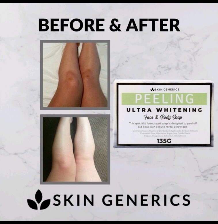 Skin Generics PEELING Ultra Whitening Face & Body Soap 135g