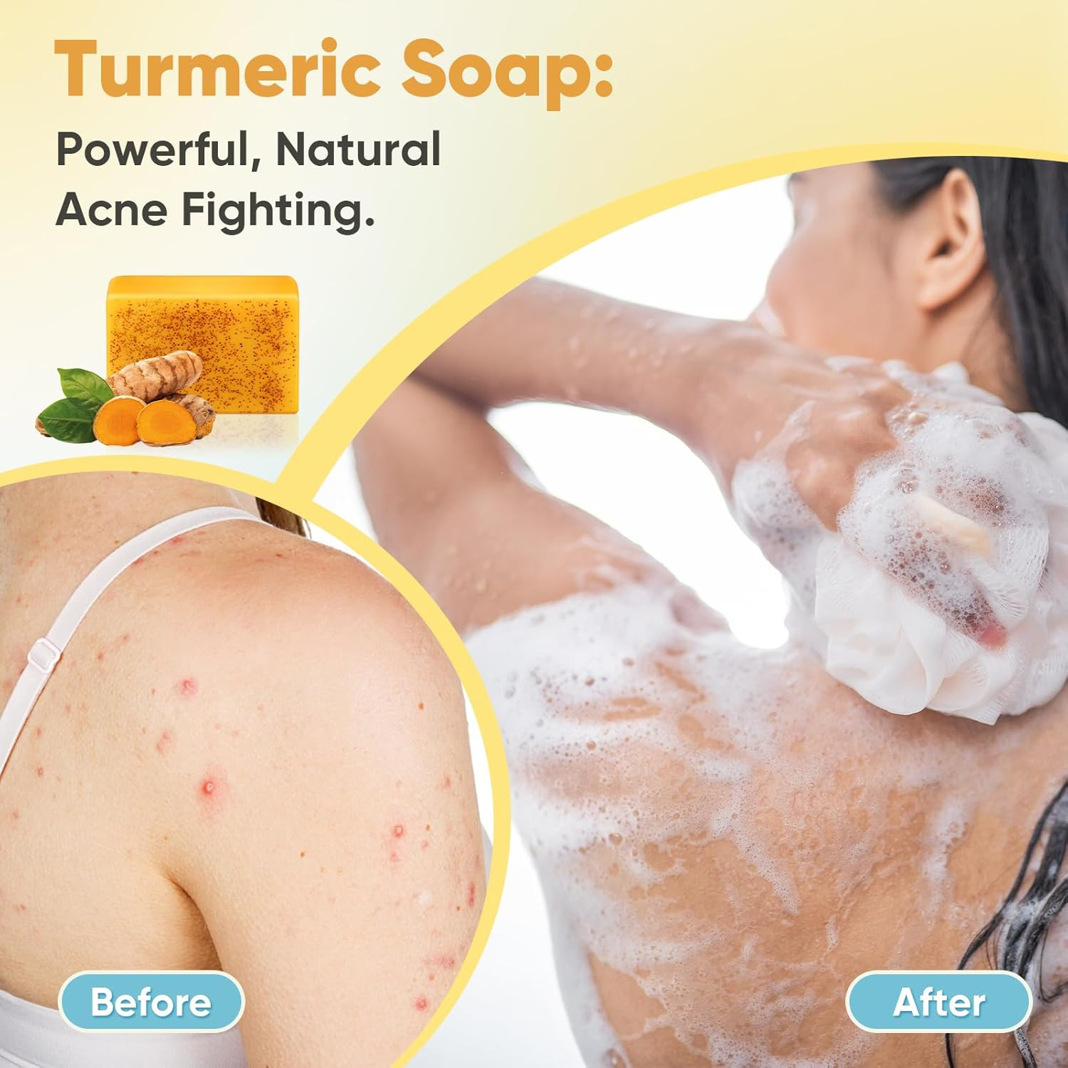 4 Pack Turmeric Soap, 100G Kojic Acid and Turmeric Soap Bar, Gently Clean the Fa