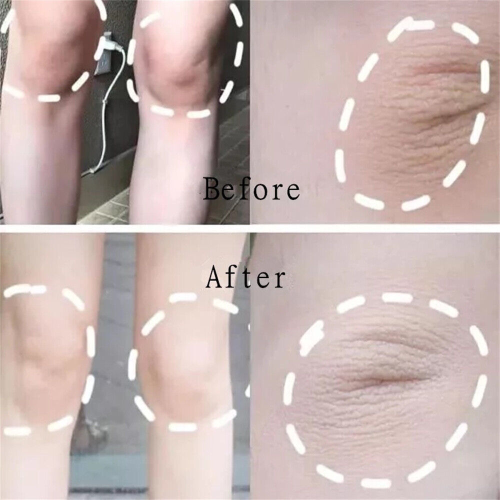 Kojic Acid Soap Dark Skin Whitening Bleaching Lightening Brightening Face & Body