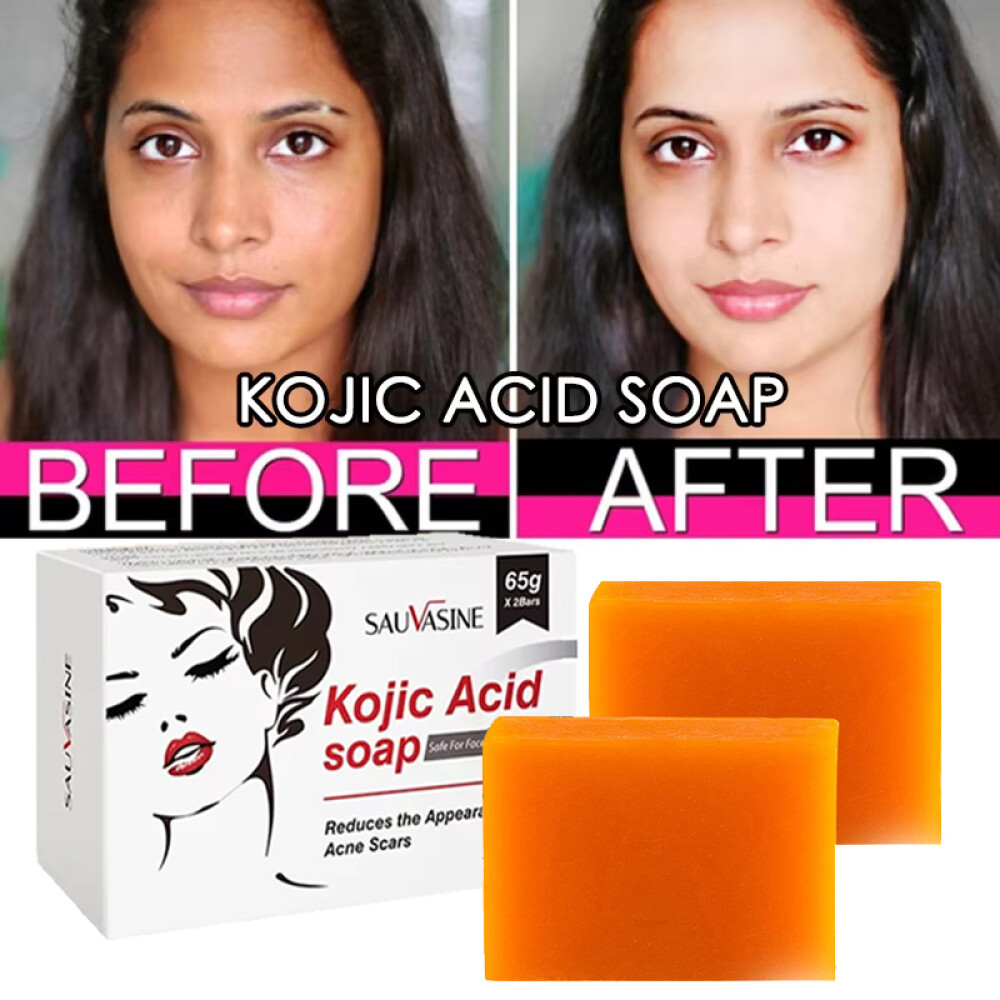 5/3X Kojic Acid Soap Acne Dark Spot Remover Skin Lightening Whitening Face Body