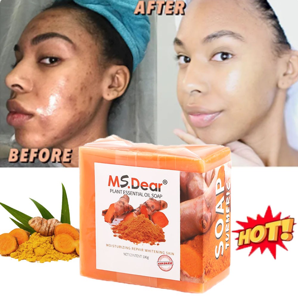3/1x Tumeric Soap Skin Whitening Dark Spots lightening Acne Brightening Turmeric