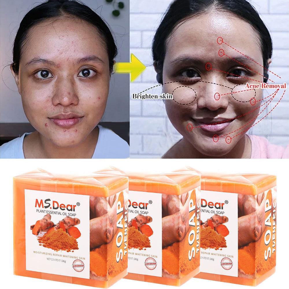 10x Tumeric Soap Skin Whitening Dark Spots lightening Acne Brightening Turmeric