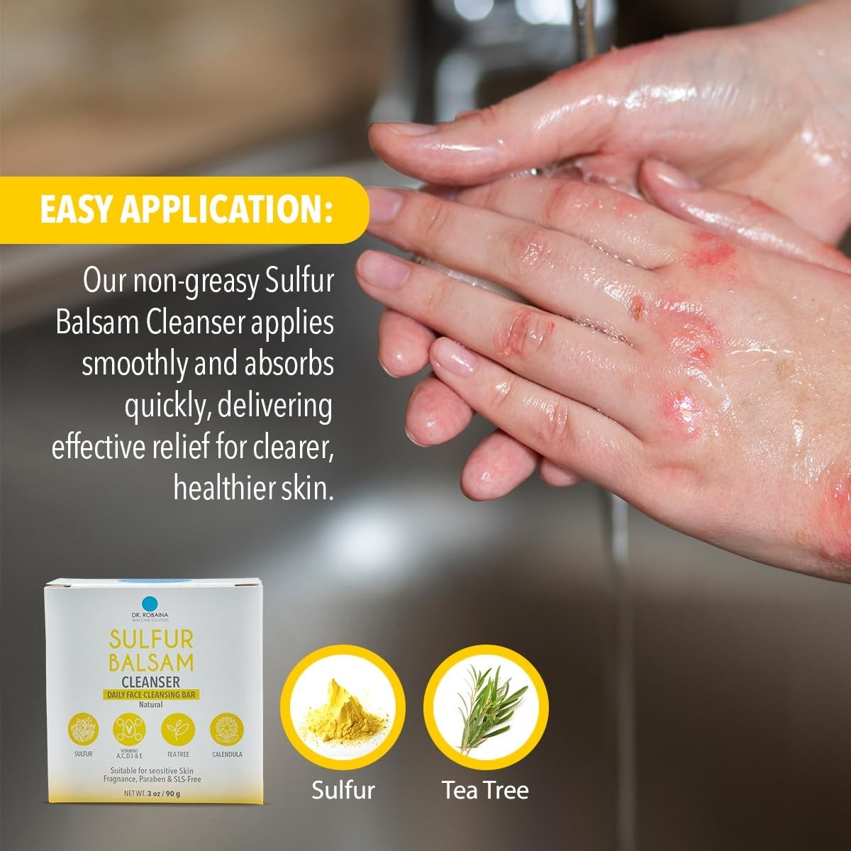 Soothing Tea Tree & Calendula Soap Bar – Chemical-Free Acne Treatment, 4 oz