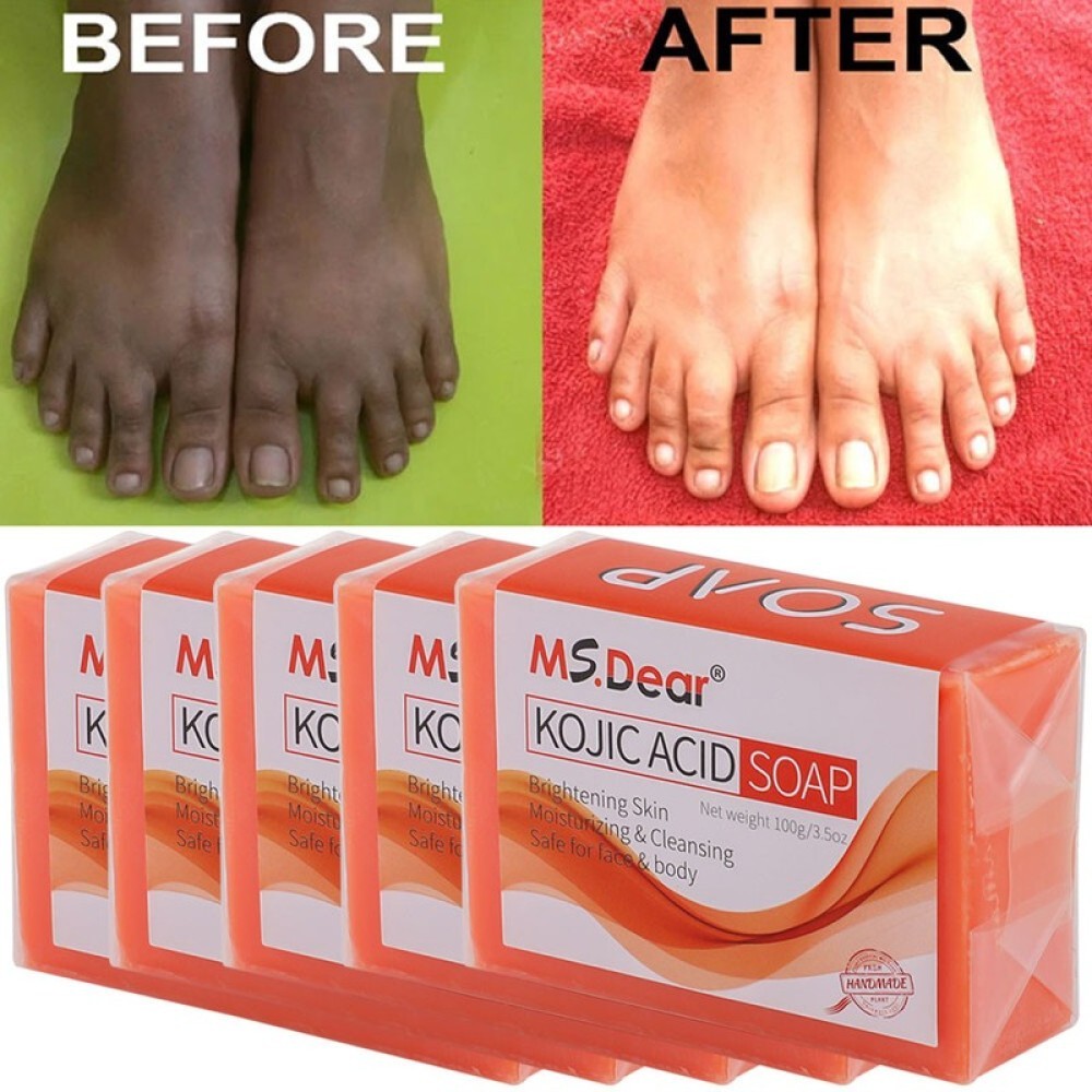 Kojic Acid/Tumeric Soap Skin Whitening Dark Spots lightening Acne Brightening US