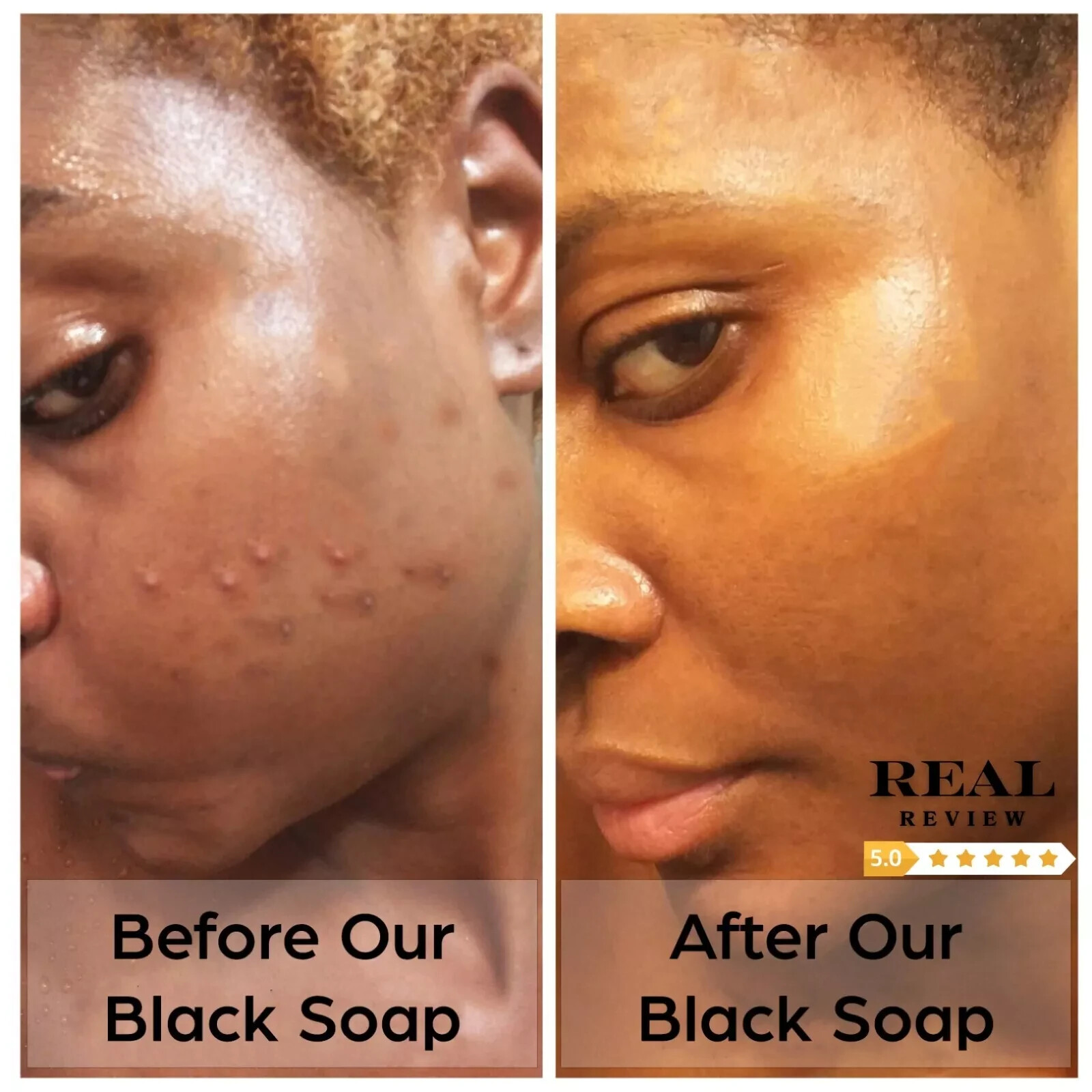 Raw African Black Soap 8 oz. Unrefined Organic Natural Skin Body Hair Face Wash