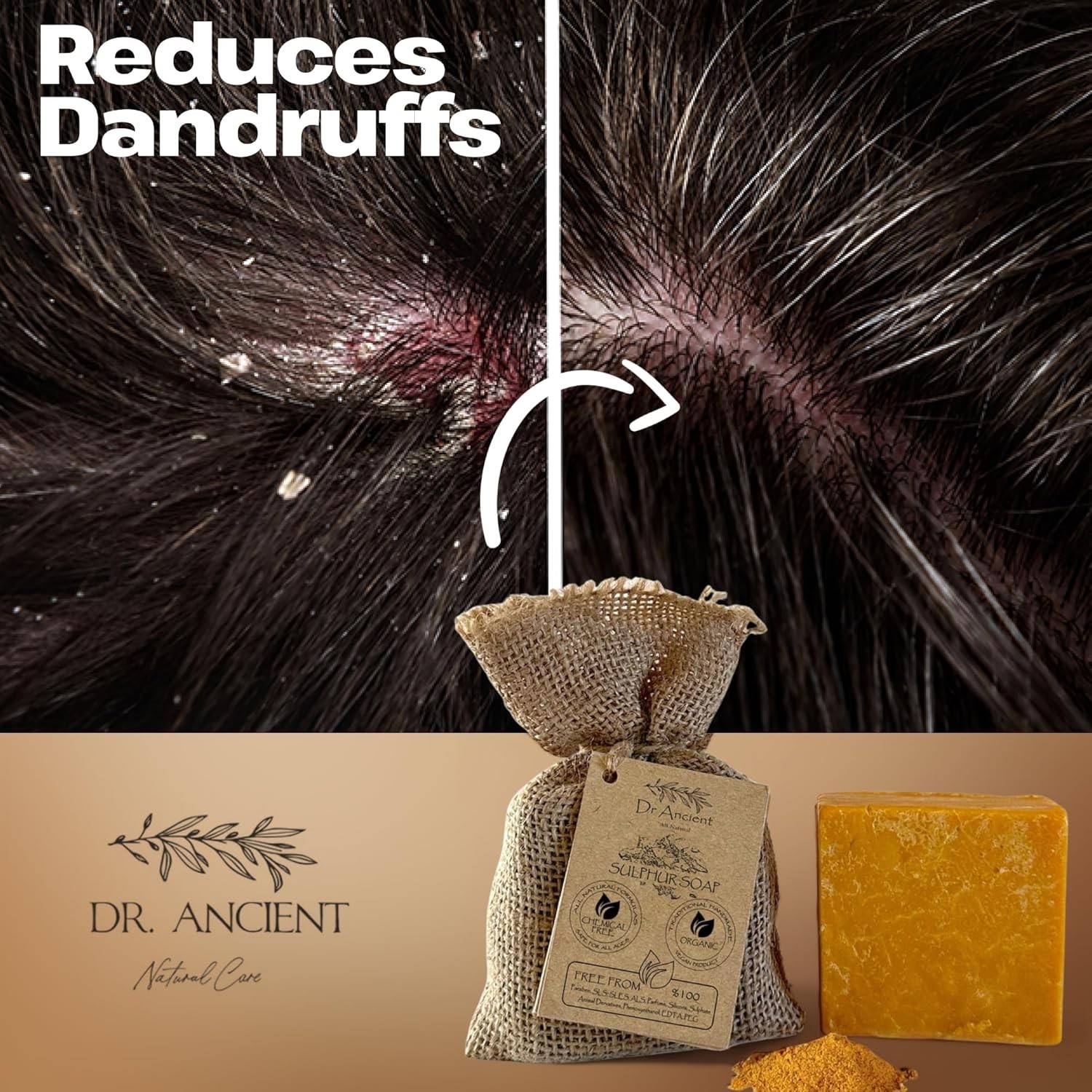 Chemical-Free Organic Sulfur Soap Bar – Perfect for Oily Skin & Acne Treatment