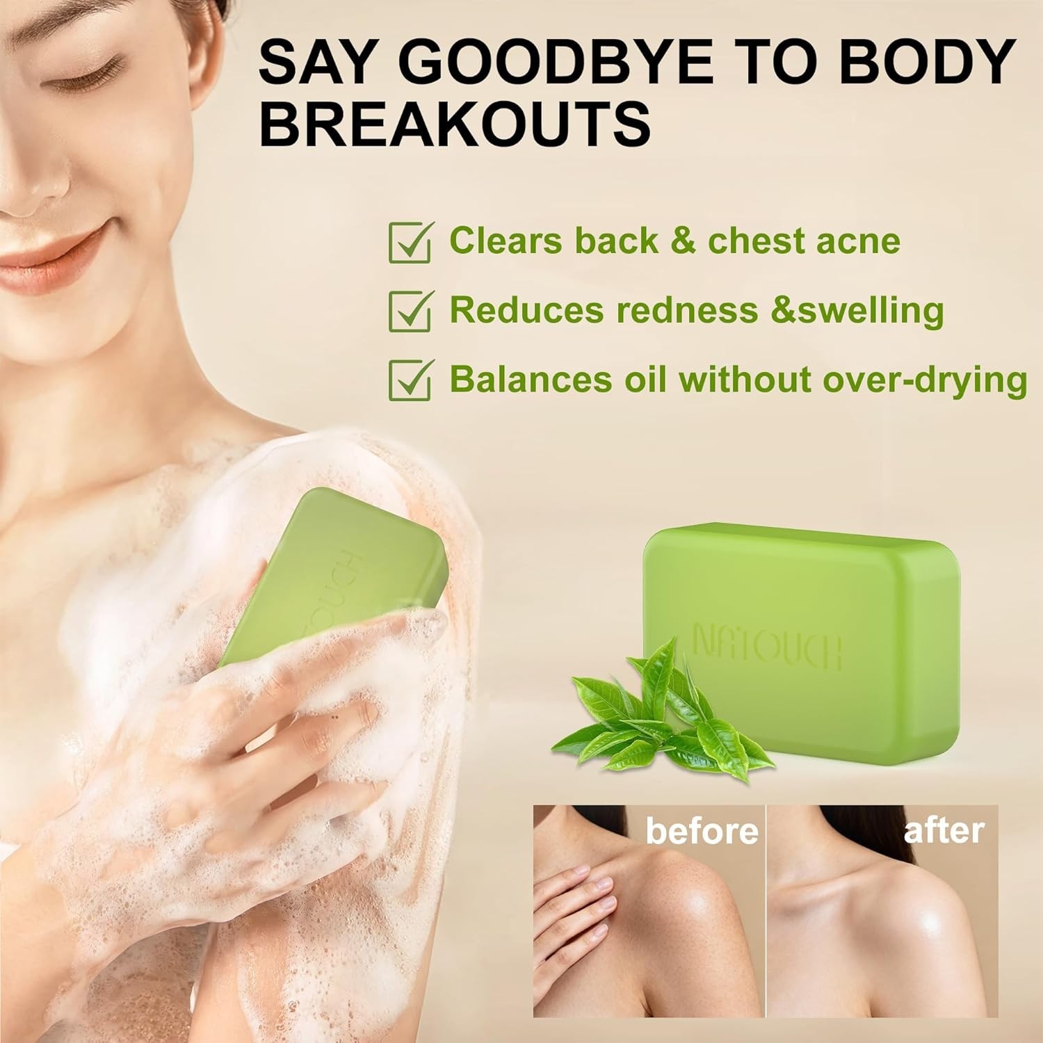 Antifungal Medicated Soap Bar, Athletes Foot Jock Itch Ringworm Yeast Infection