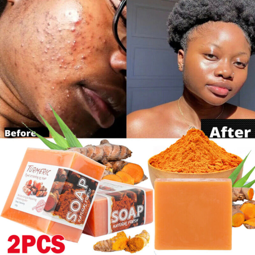 2 Pcs Tumeric Soap, Dark Spots , Skin Glow, Brighter Skin, Scars, All Skin types