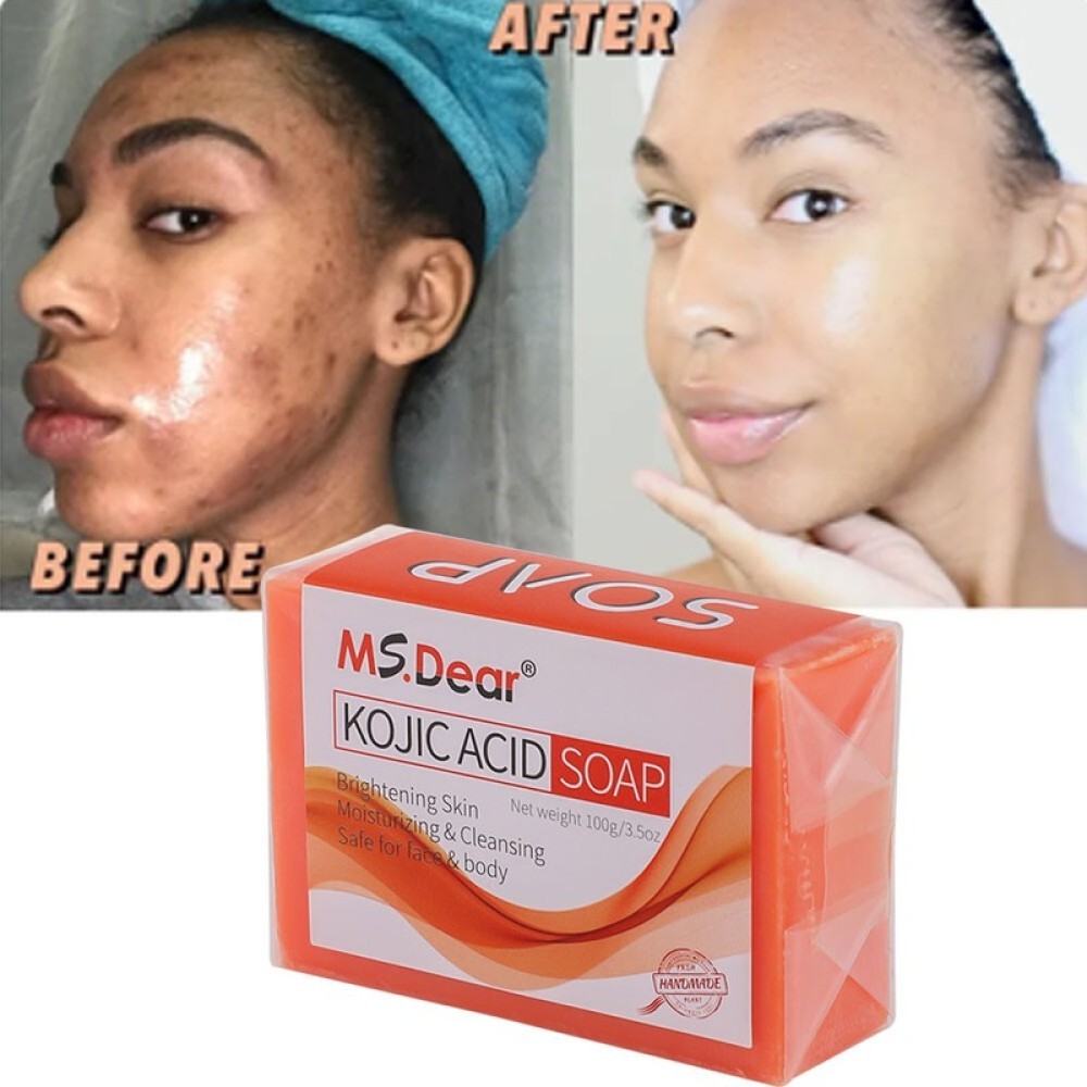 Dark Skin Whitening Bleaching Lightening Kojic Acid Soap Brightening Face & Body