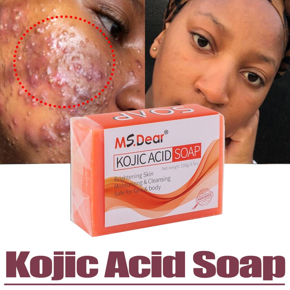 Dark Skin Whitening Bleaching Lightening Kojic Acid Soap Brightening Face & Body
