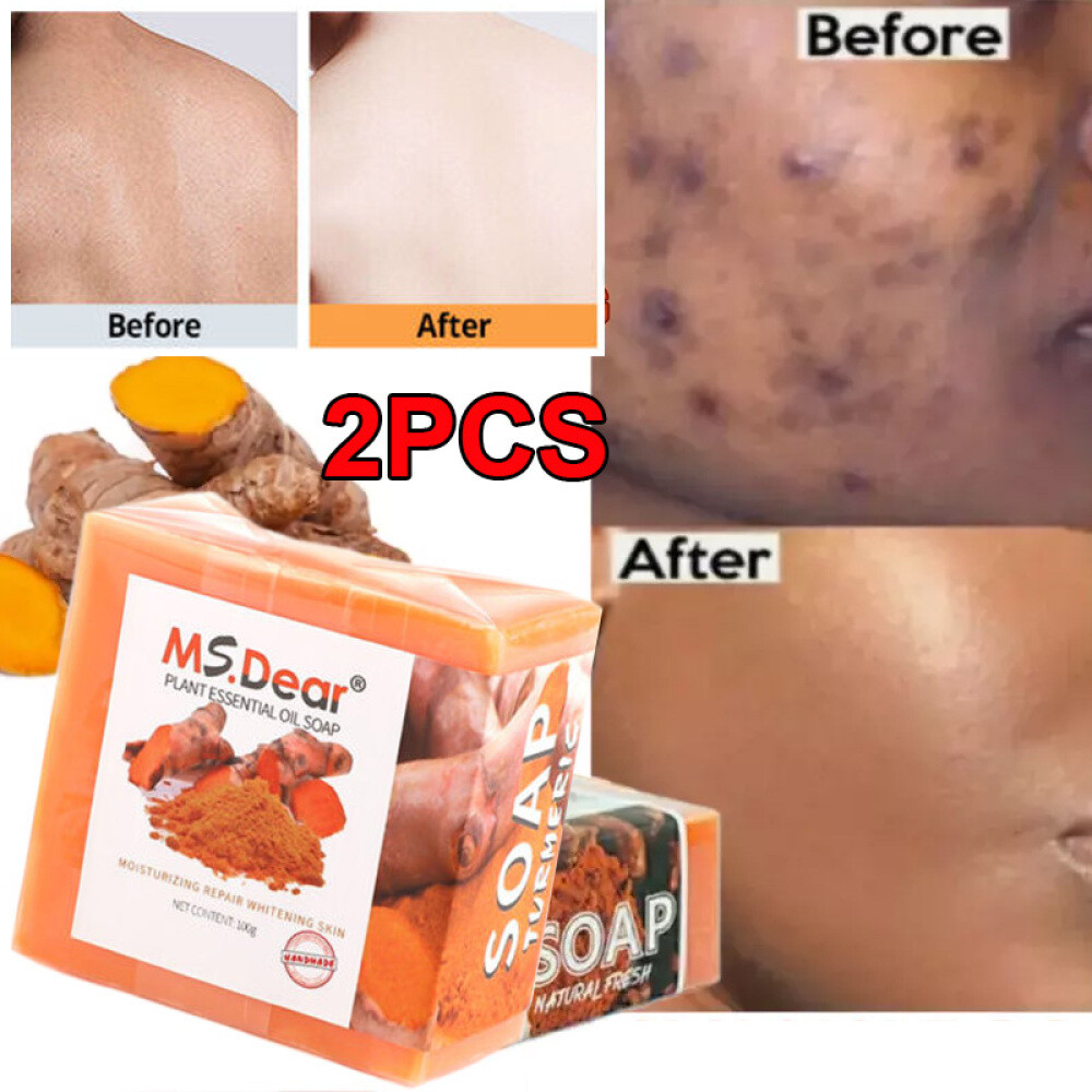 2x Tumeric Soap Acne Dark Spot Removal Skin Whitening Facial Body Bleaching Soap