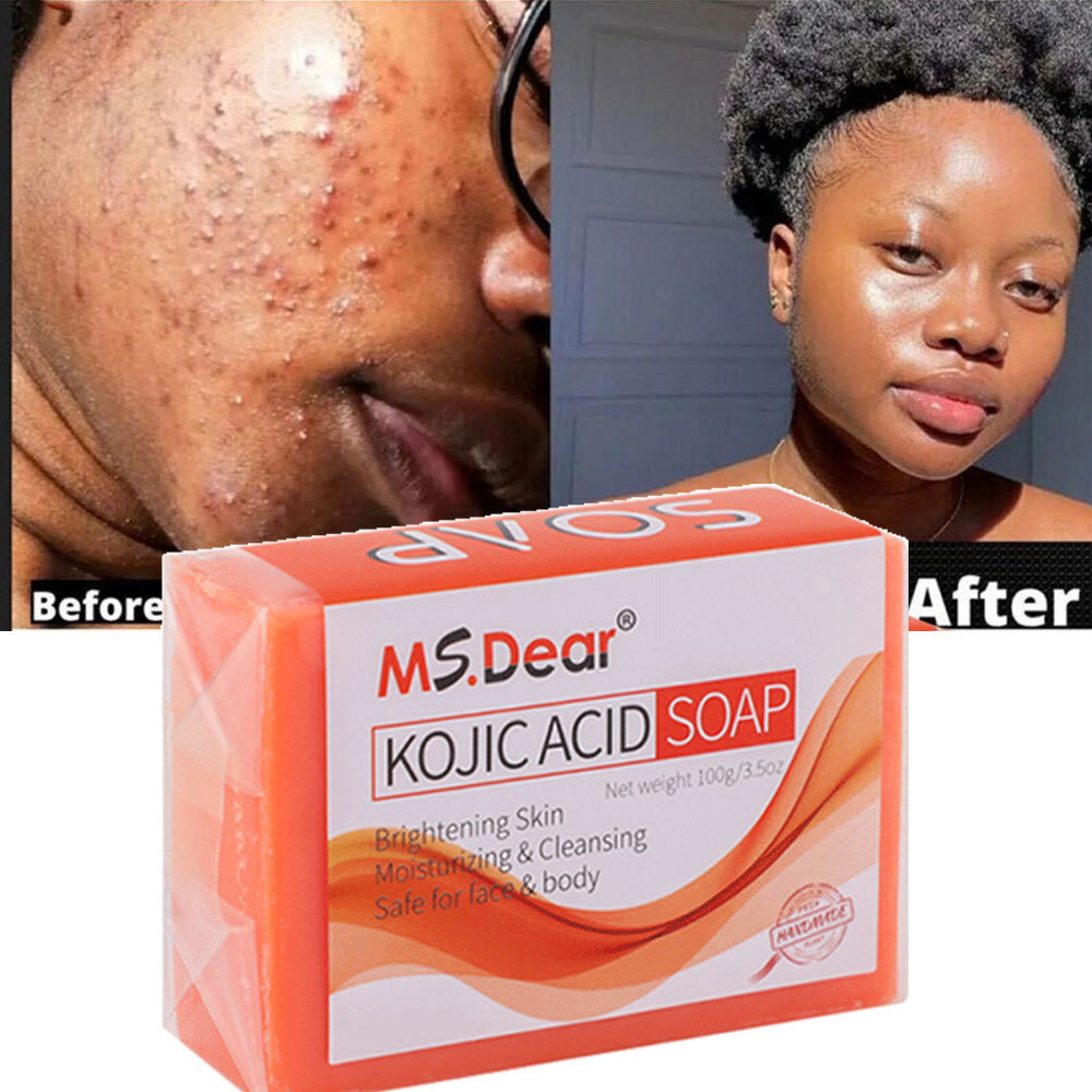 1/2/5 Kojic Acid Dark Spot Remover Skin Lightening Face Whitening Body Bleaching